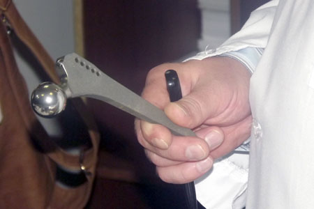 Лечение перелома шейки бедра в челябинске